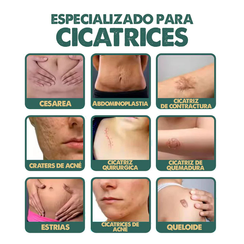 South Moon - Spray Elimina Cicatrices