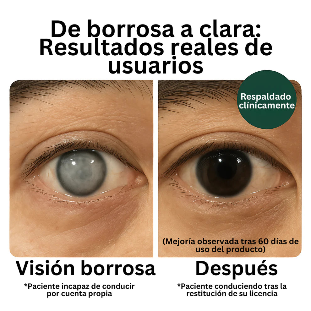 Zooone - Vitaminas Para Los Ojos
